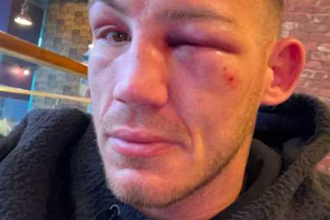 Liam Williams shows off brutal eye injury and battered face after Chris Eubank Jr beating including ..