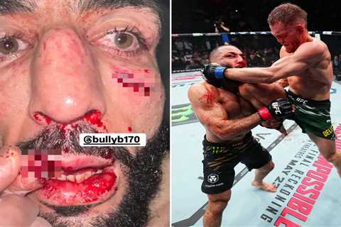 EXCLUSIVE: Bloody Brawl! UFC Champion Left with Split Lip After Gruesome Defeat!
